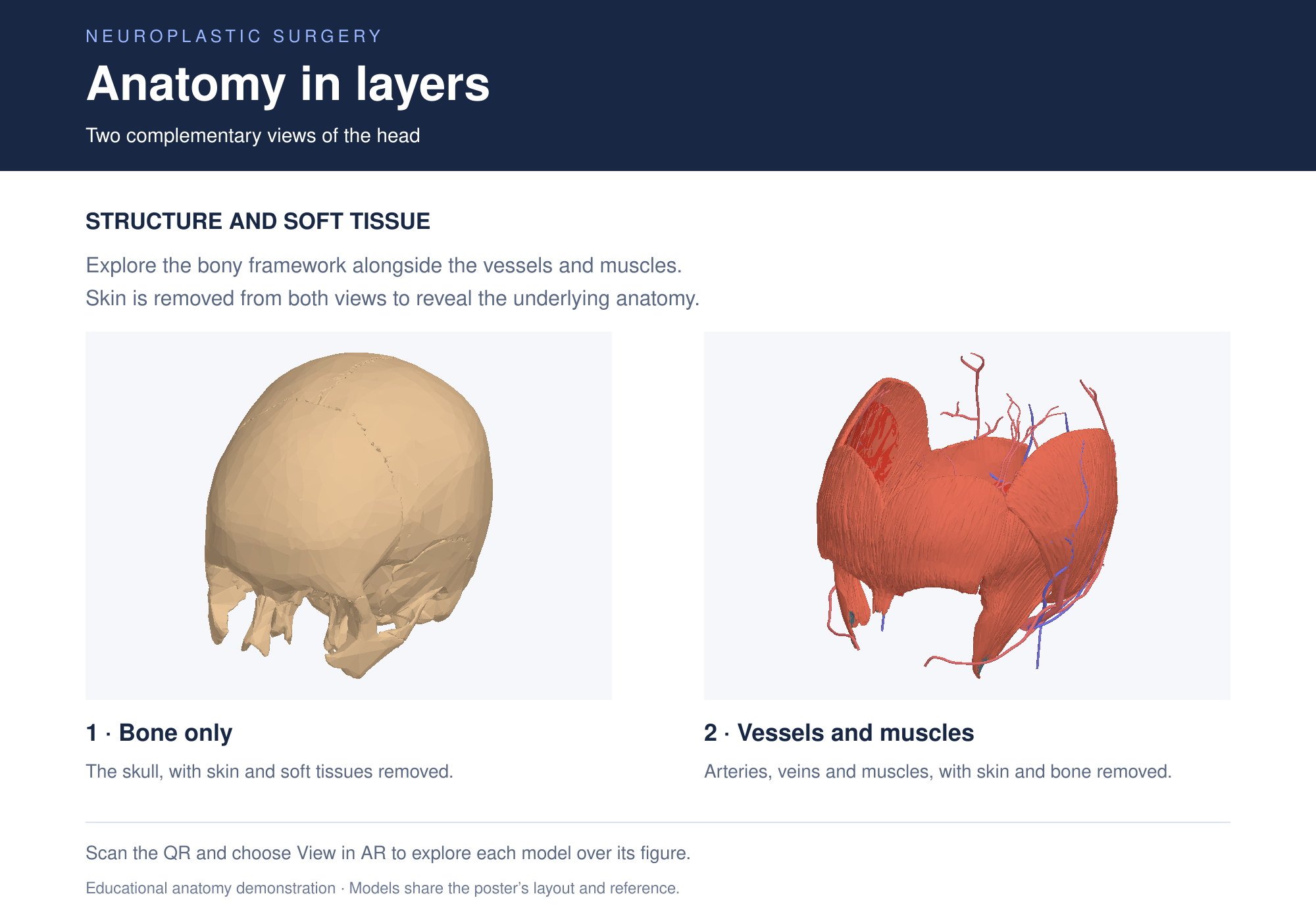 Neuroplastic surgery poster with labeled bone and vessels-and-muscles figures